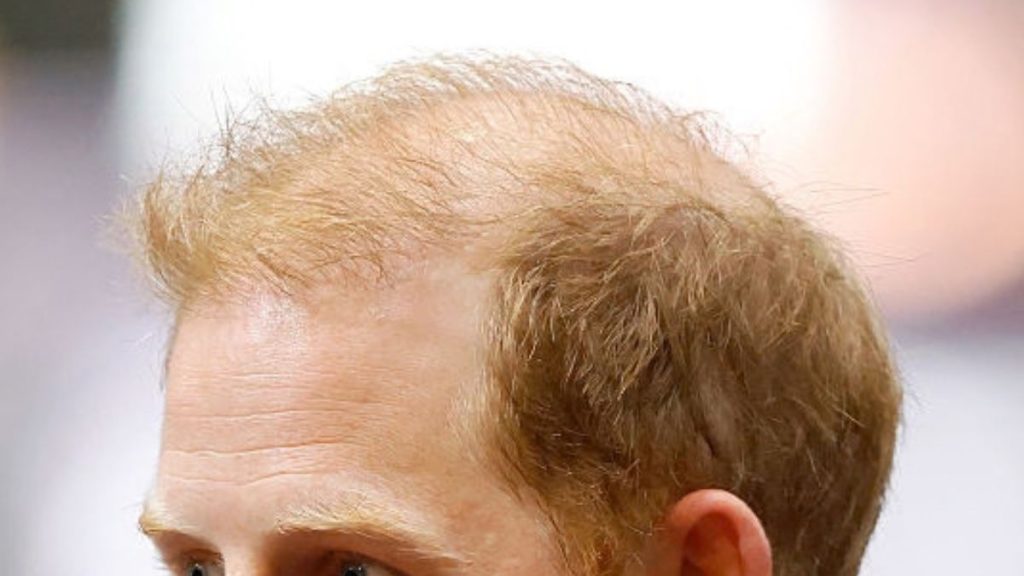 Haaruitval tegengaan? Finasteride en wat écht werkt – Wellumo